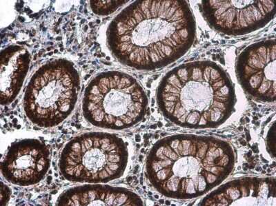 Immunohistochemistry-Paraffin: CDK2 [p Thr160] Antibody [NBP3-13301]